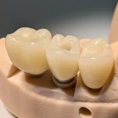 PXL_20250522_112048506 - PXL_20250522_112052894