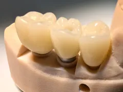 PXL_20250522_112106903 - PXL_20250522_112109896