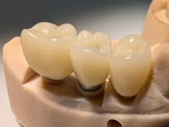 PXL_20250522_112103788 - PXL_20250522_112106903