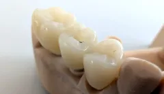 PXL_20250522_112024100 - PXL_20250522_112026110