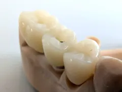 PXL_20250522_112026110 - PXL_20250522_112028078