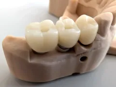 PXL_20250522_112009980 - PXL_20250522_112011951