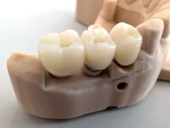 PXL_20250522_112011951 - PXL_20250522_112014267