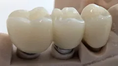 PXL_20250522_111944150 - PXL_20250522_111946349