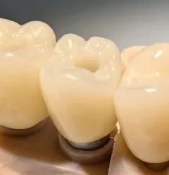 PXL_20250522_112050685 - PXL_20250522_112052894