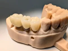 PXL_20250522_112050685 - PXL_20250522_112052894